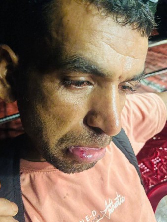मजदुर राई भन्छन् म माथ ि कुटपिट भयो, घर मालिक अर्याल भन्छन् - मलाई नसोधी मेरो घर कब्जा गरियो !