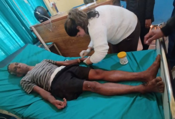 बुटवल पावर कम्पनीको लापरबाही:-उपभोक्ता करेन्टले जलेर अस्पताल भर्ना,सरोकारवाला पक्षलाई छैन कुनै चासो